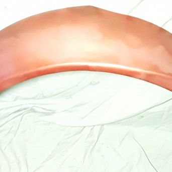 Nadkole tył zewn. P PN